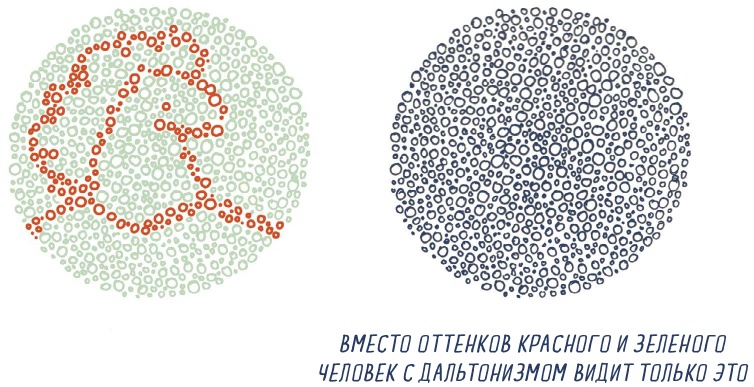В моей голове