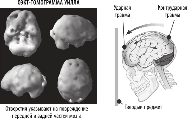 Полюби свой мозг