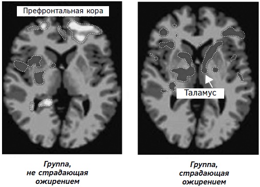 Мозг: прошлое и будущее