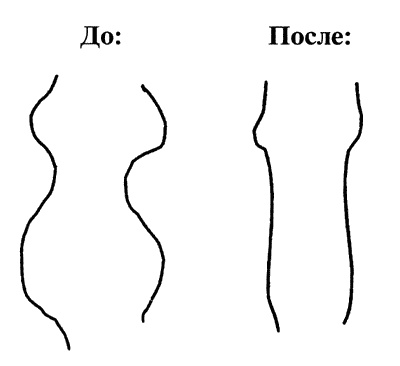 Белые зубы