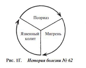 Мигрень Мигрень