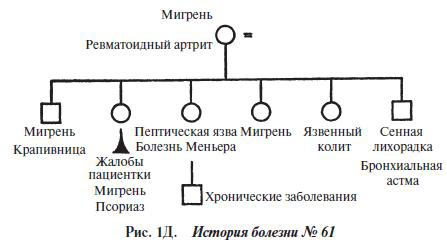 Мигрень Мигрень