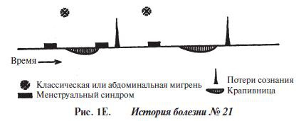 Мигрень Мигрень