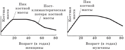 Остеопороз. Тихая эпидемия XXI века Остеопороз. Тихая эпидемия XXI века