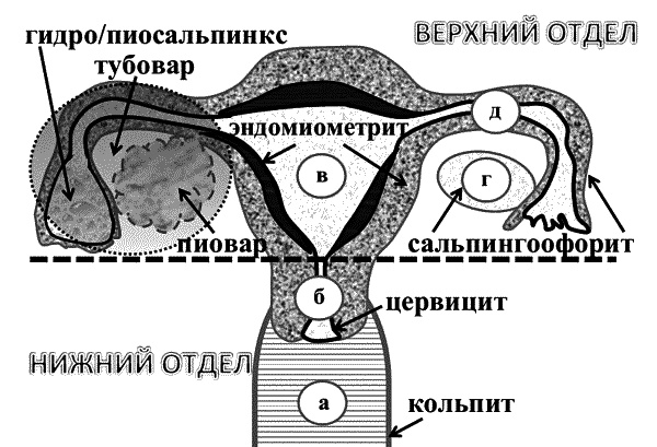 Бесплодие – не приговор! Бесплодие – не приговор!
