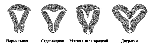 Бесплодие – не приговор! Бесплодие – не приговор!