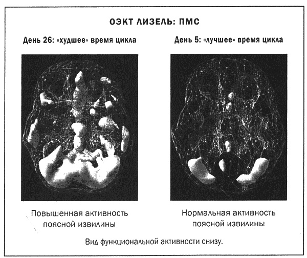 Мозг и душа. Новые открытия о влиянии мозга на характер, чувства, эмоции