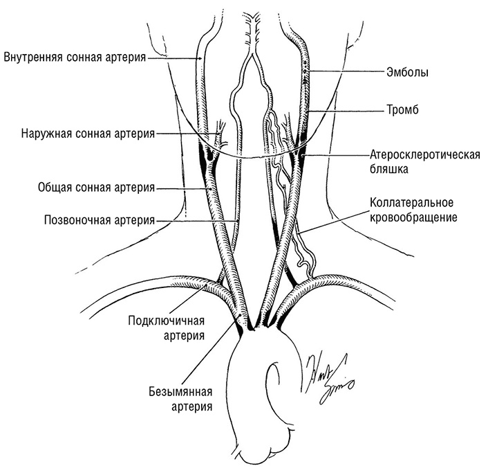 Здоровое сердце. Издание XXI века Здоровое сердце. Издание XXI века