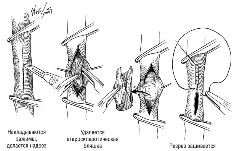 Здоровое сердце. Издание XXI века Здоровое сердце. Издание XXI века