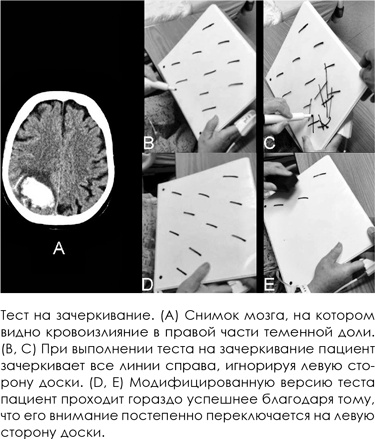 НейроЛогика. Чем объясняются странные поступки, которые мы совершаем неожиданно для себя НейроЛогика. Чем объясняются странные поступки, которые мы совершаем неожиданно для себя