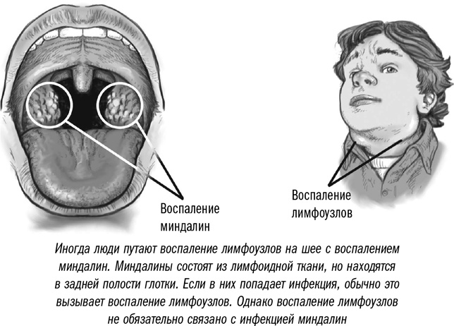 Первая помощь своими руками. Если скорая не спешит Первая помощь своими руками. Если скорая не спешит
