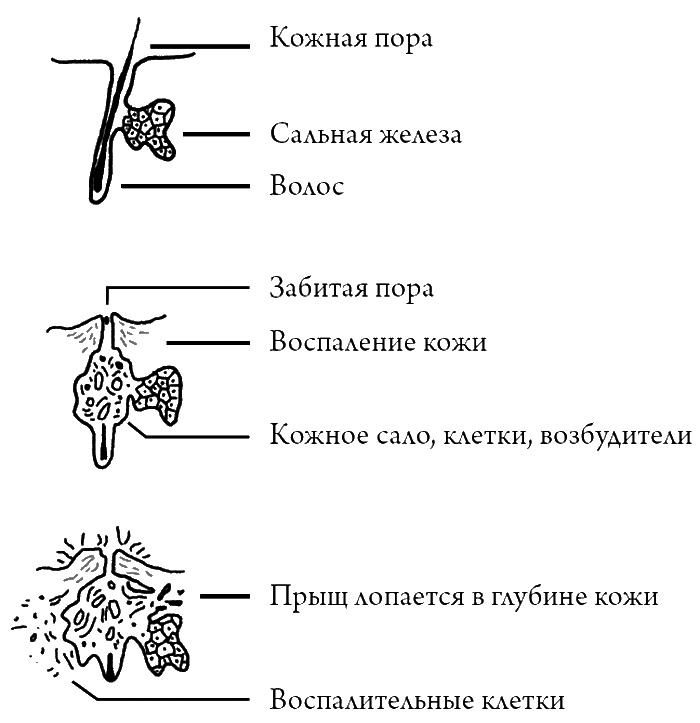 Что скрывает кожа. 2 квадратных метра, которые диктуют, как нам жить Что скрывает кожа. 2 квадратных метра, которые диктуют, как нам жить
