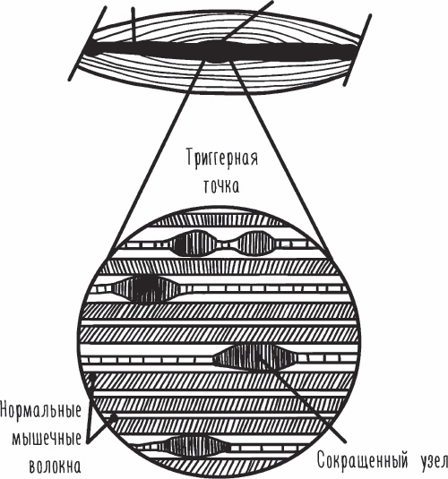 Благодарный позвоночник. Как навсегда избавить его от боли. Домашняя кинезиология Благодарный позвоночник. Как навсегда избавить его от боли. Домашняя кинезиология