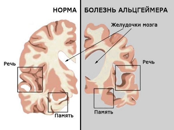 Теломераза. Как сохранить молодость, укрепить здоровье и увеличить продолжительность жизни