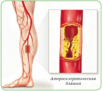 Энциклопедия диагностики и лечения от А до Я