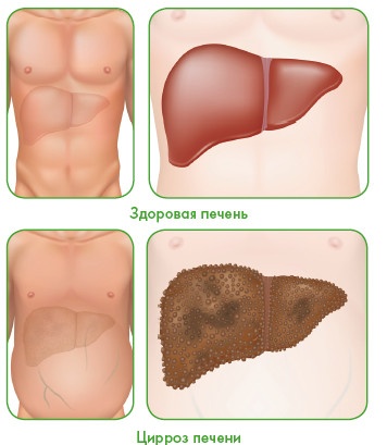 Энциклопедия диагностики и лечения от А до Я