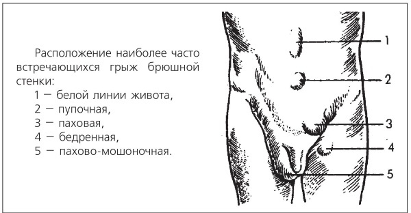 Болезни от А до Я. Традиционное и нетрадиционное лечение Болезни от А до Я. Традиционное и нетрадиционное лечение