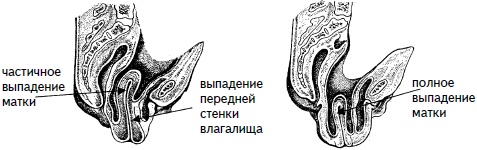 Гимнастика для женщин Гимнастика для женщин