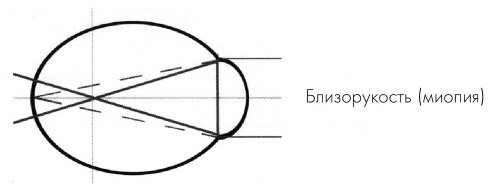 Как учиться и не испортить зрение