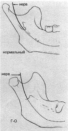 Эректус бродит между нами. Покорение белой расы Эректус бродит между нами. Покорение белой расы