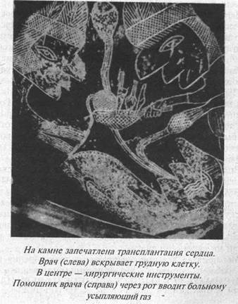 Загадки острова Пасхи Загадки острова Пасхи