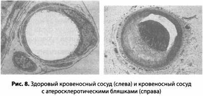 Психология стресса Психология стресса
