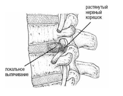 Настольная книга для тех, у кого болит спина Настольная книга для тех, у кого болит спина