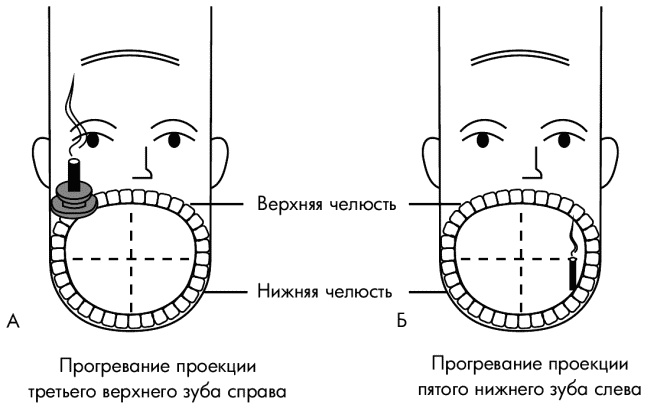 Су-Джок лечит. Мигрень, кашель, боль в спине, тяжесть в желудке Су-Джок лечит. Мигрень, кашель, боль в спине, тяжесть в желудке