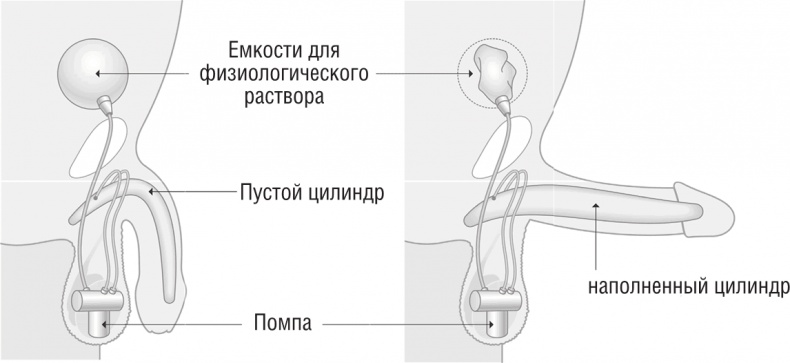 ОН. Интимный разговор про тот самый орган ОН. Интимный разговор про тот самый орган