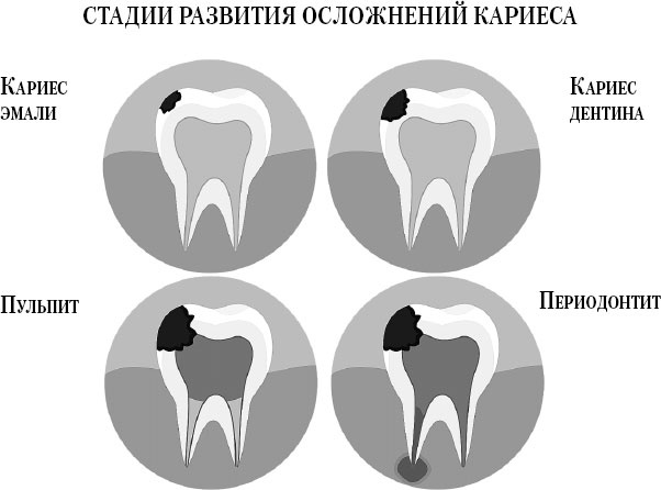 Злые зубы Злые зубы