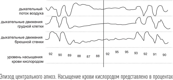 Загадки сна
